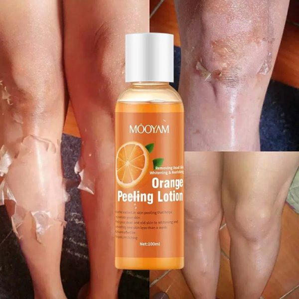 Peeling Lotion